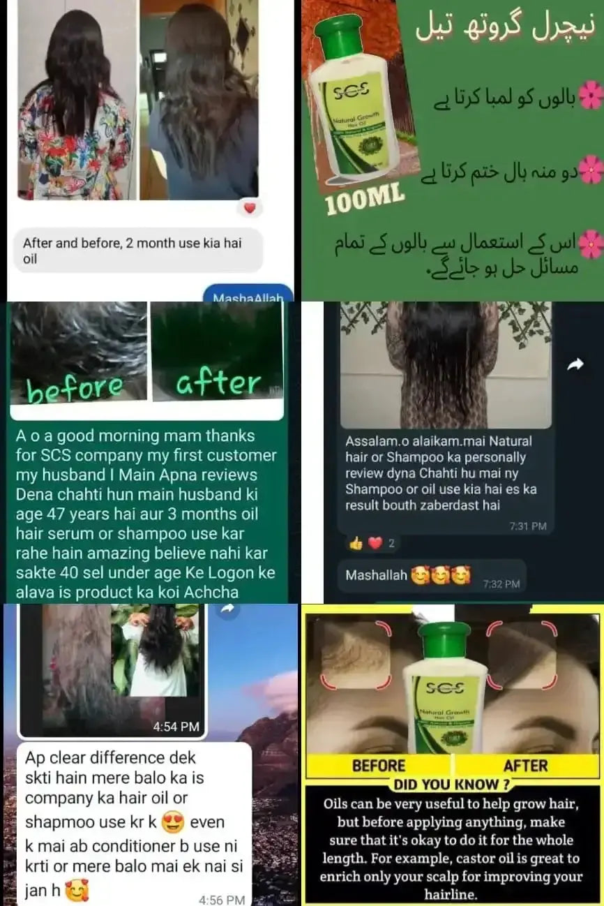 Hair Growth Oil & Shampoo – Fast Hairline Growth with Rosemary Cosmetics ZauqRoz 
